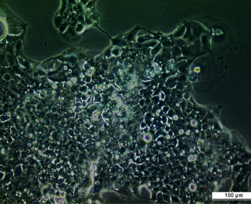 UM-UC-7 Cell Line. Image courtesy of the European Collection of Authenticated Cell Cultures (ECACC), UK.