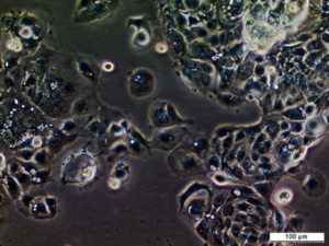 UM-UC-7 Cell Line. Image courtesy of the European Collection of Authenticated Cell Cultures (ECACC), UK.