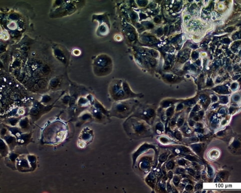 UM-UC-7 Cell Line. Image courtesy of the European Collection of Authenticated Cell Cultures (ECACC), UK.