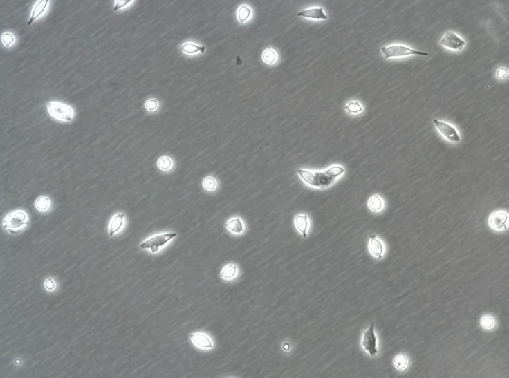 A2780cis Cell Line. 24 hours post plating. Image courtesy of the European Collection of Authenticated Cell Cultures (ECACC)
