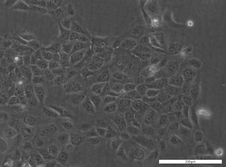 TR146 Cell Line. 3 days post plating. Image courtesy of the European Collection of Authenticated Cell Cultures (ECACC)