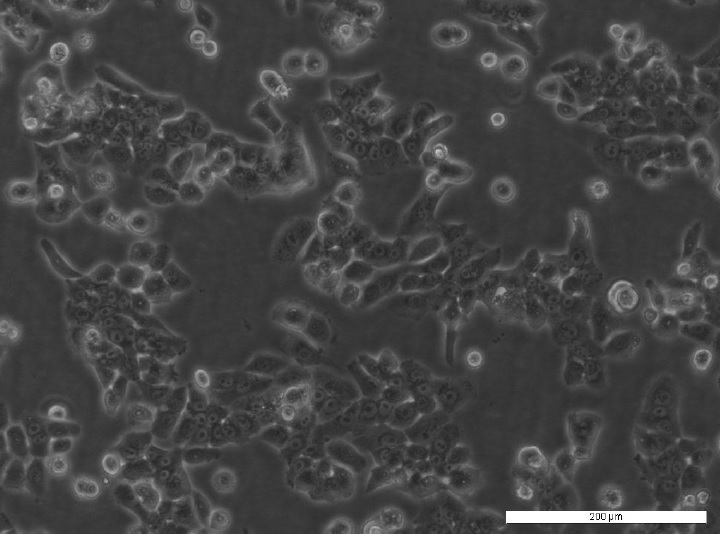PEO1 Cell Line. 3 days post plating. Image courtesy of the European Collection of Authenticated Cell Cultures (ECACC)