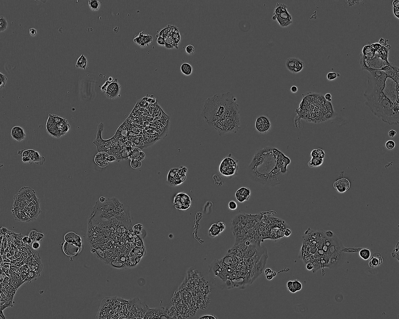 C106 Colorectal Cell Line. 3 days post plating. Image courtesy of the European Collection of Authenticated Cell Cultures (ECACC)