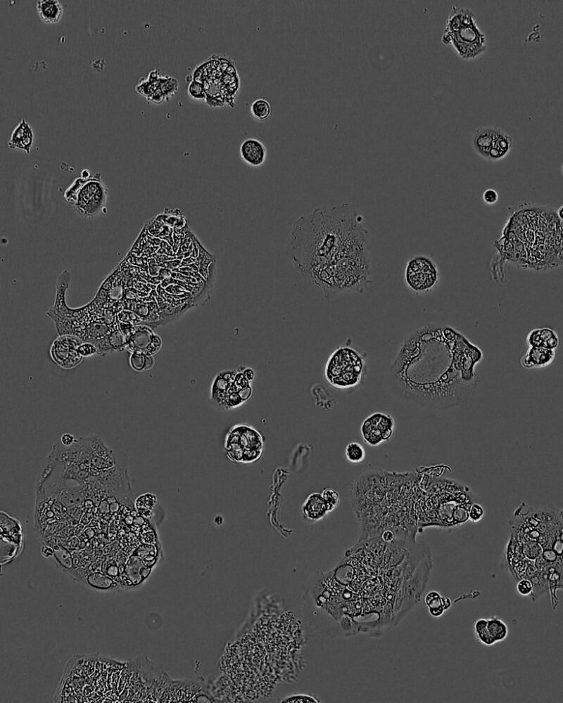 C106 Colorectal Cell Line. 3 days post plating. Image courtesy of the European Collection of Authenticated Cell Cultures (ECACC)
