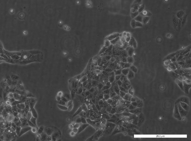 Image: PEO4 Cell Line. Image courtesy of the European Collection of Authenticated Cell Cultures (ECACC).