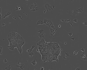 SW1222 Cell Line. 4 days post plating. Image courtesy of the European Collection of Authenticated Cell Cultures (ECACC)