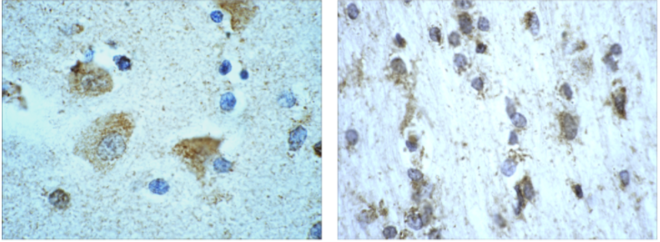 Immunohistochemical detection of Catalase in Human Brain neurons using 1 in 500 dilution of Sheep Anti-Catalase Affinity Purified Antibody.