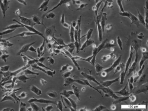 fR5 Cell Line. Image courtesy of the European Collection of Authenticated Cell Cultures (ECACC)