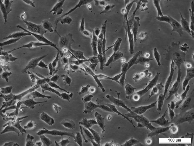 fR5 Cell Line. Image courtesy of the European Collection of Authenticated Cell Cultures (ECACC), UK.