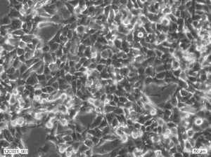 2fTGH Cell Line. Image courtesy of the European Collection of Authenticated Cell Cultures (ECACC)
